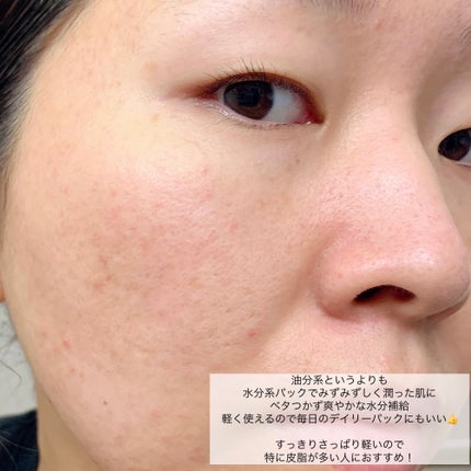 ミントAHA/BHA/PHAリフレッシュマスク/ttat/シートマスク・パックを使ったクチコミ(9枚目)