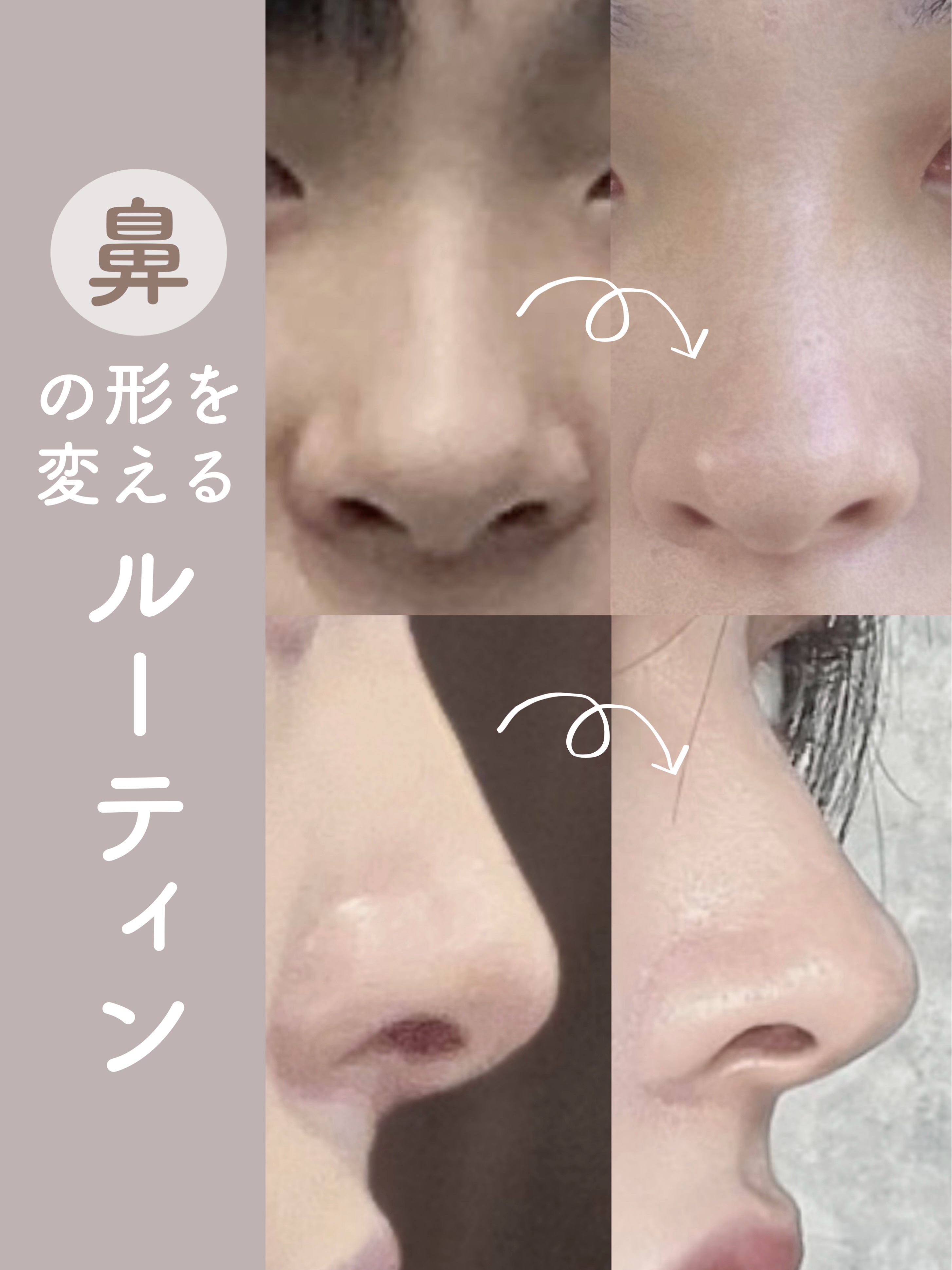 カバー＆ストレッチコンシーラー UV/キャンメイク/リキッドコンシーラーを使ったクチコミ（1枚目）