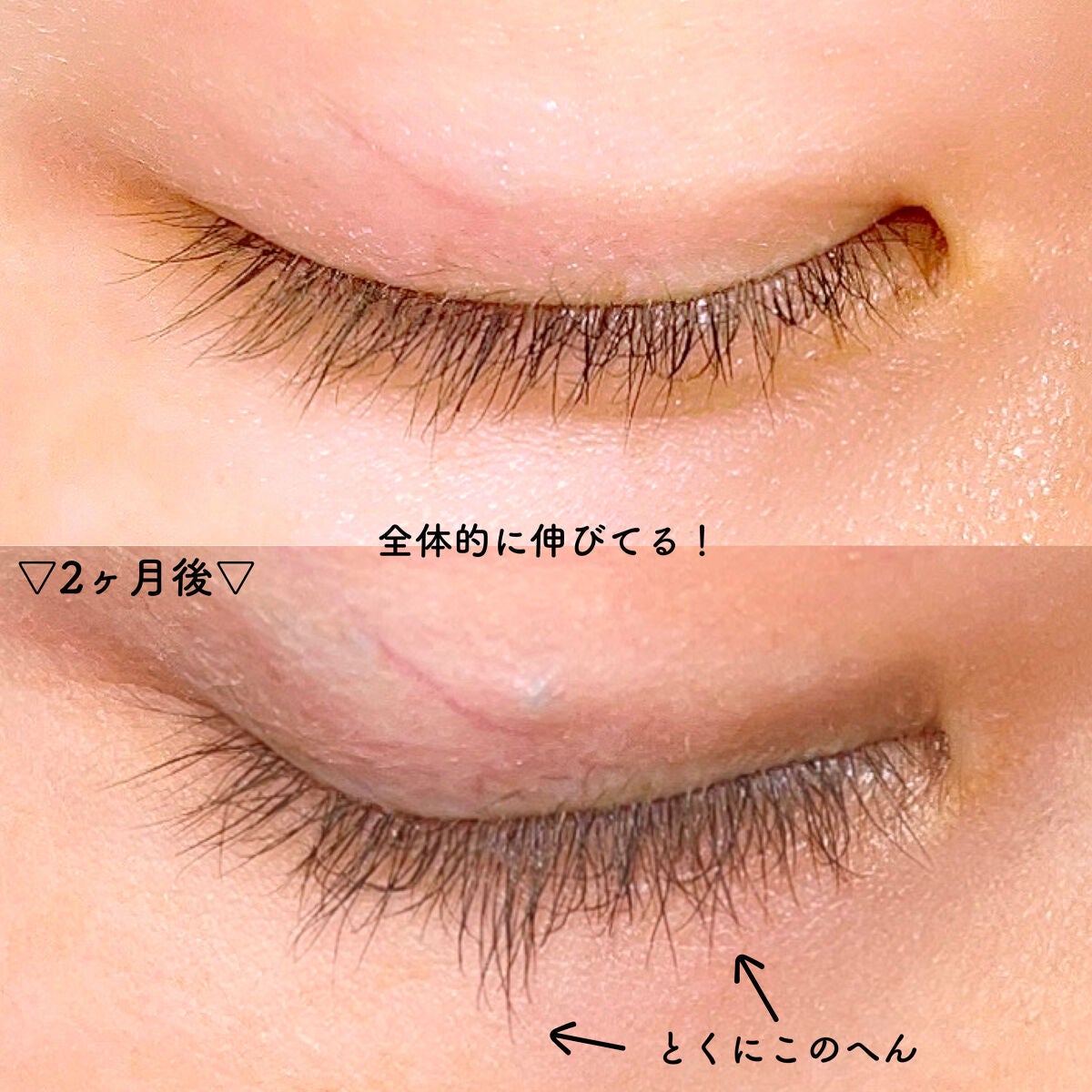 EMAKED(エマーキット)/水橋保寿堂製薬/まつげ美容液を使ったクチコミ(2枚目)