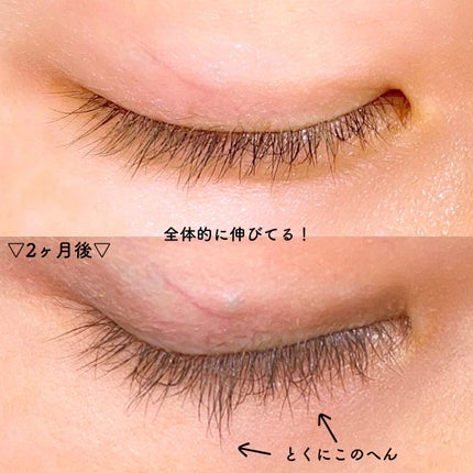 EMAKED(エマーキット)/水橋保寿堂製薬/まつげ美容液を使ったクチコミ(2枚目)