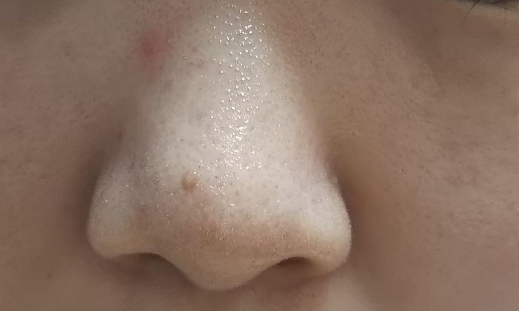 精製水(医薬品)/日本薬局方/その他を使ったクチコミ（3枚目）