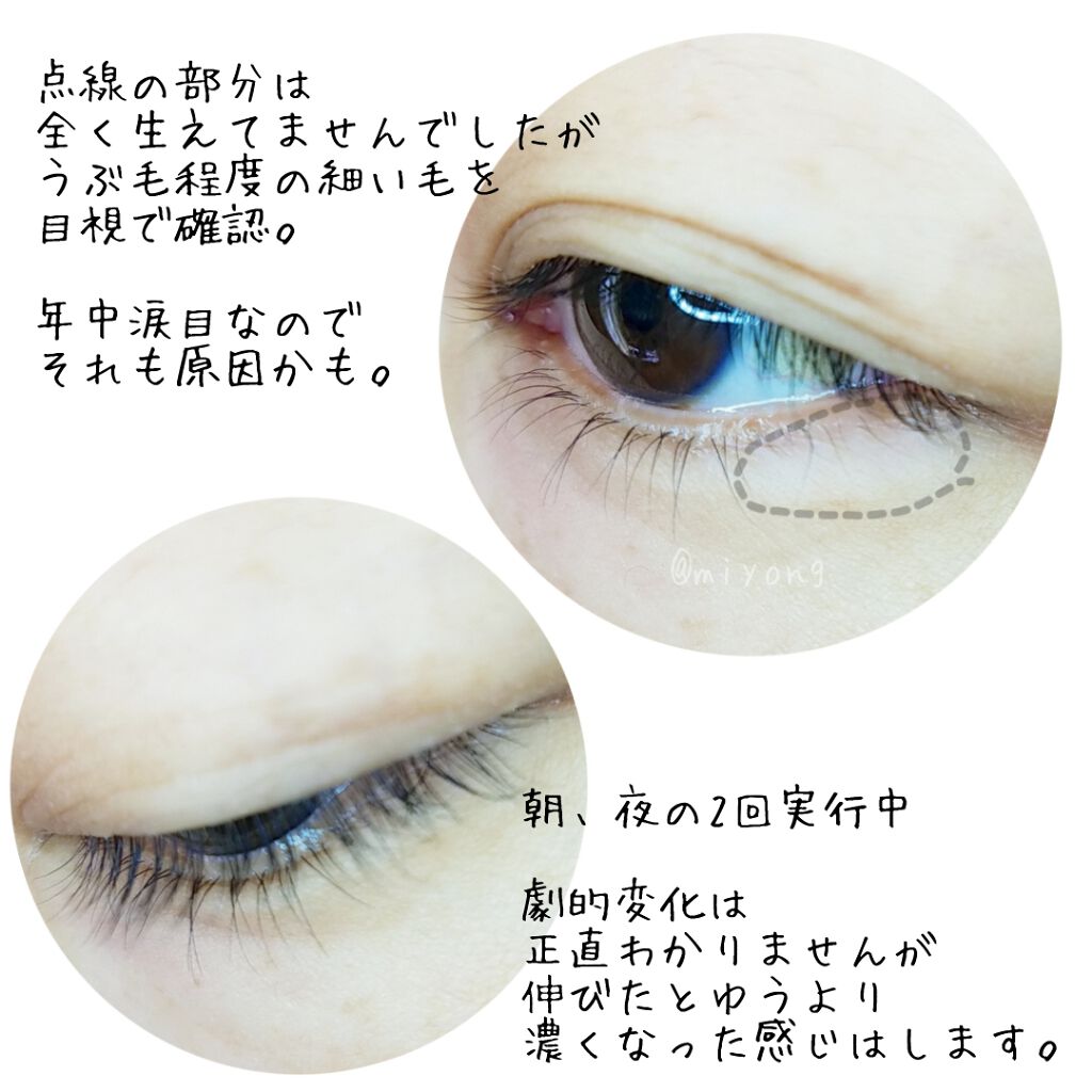 ラッシュジェリードロップ　ＥＸ/MAJOLICA MAJORCA/まつげ美容液を使ったクチコミ（2枚目）