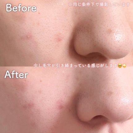 ゼロ毛穴パッド 2.0/MEDICUBE/トナーパッドを使ったクチコミ(7枚目)