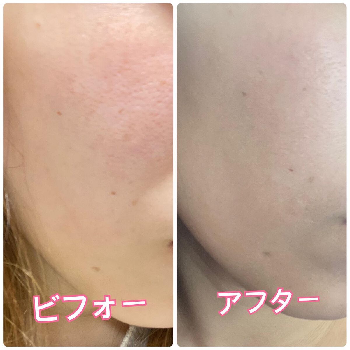 リードルショット100/VT/美容液を使ったクチコミ(4枚目)