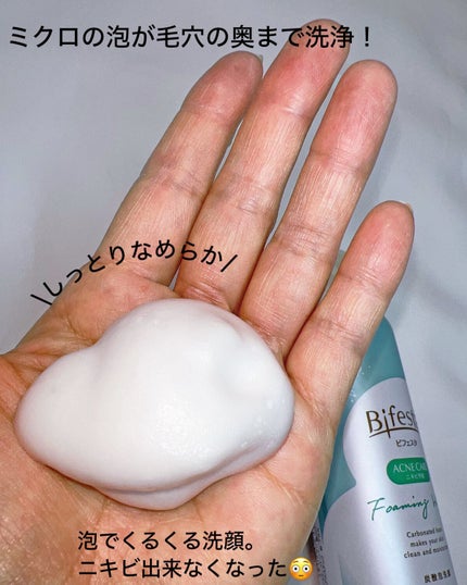 泡洗顔 コントロールケア(医薬部外品)/ビフェスタ/泡洗顔を使ったクチコミ(7枚目)