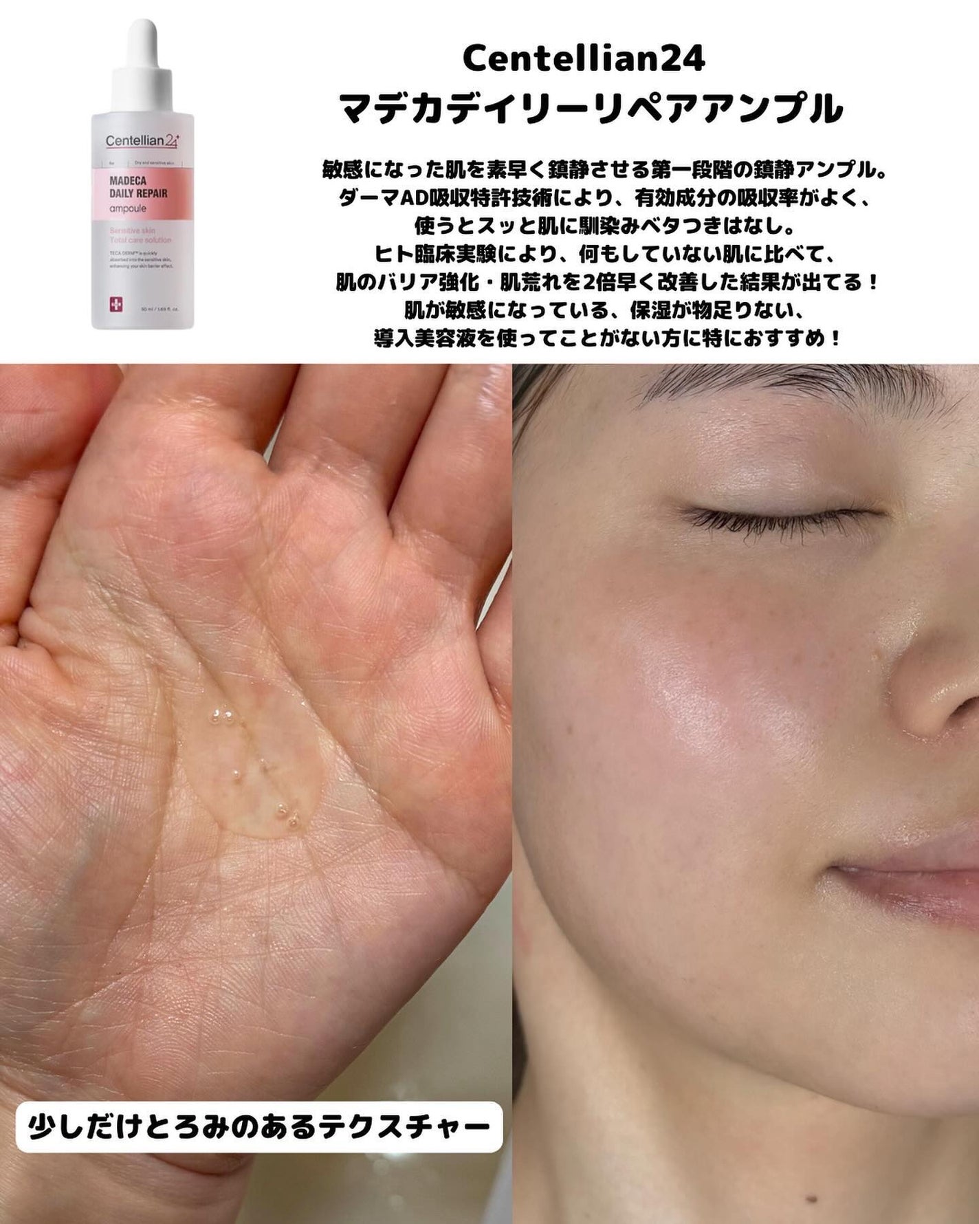 マデカダーママスクⅢ インセンティブフォーミュラ/センテリアン24/シートマスク・パックを使ったクチコミ(2枚目)