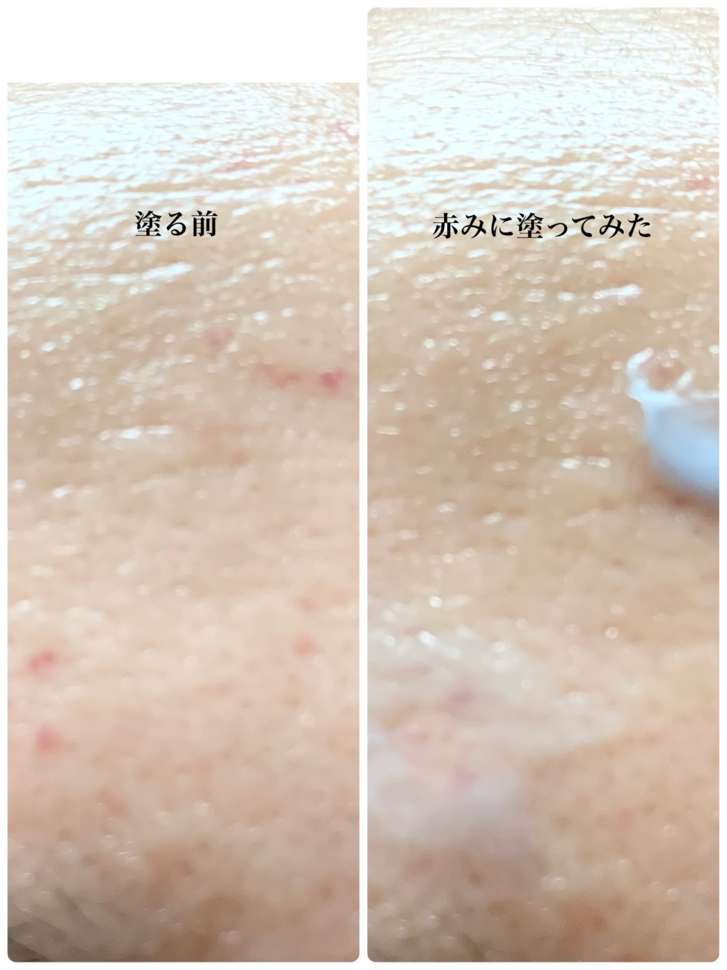 PHセンシティブスポットクリーム/SAM'U/フェイスクリームを使ったクチコミ(4枚目)