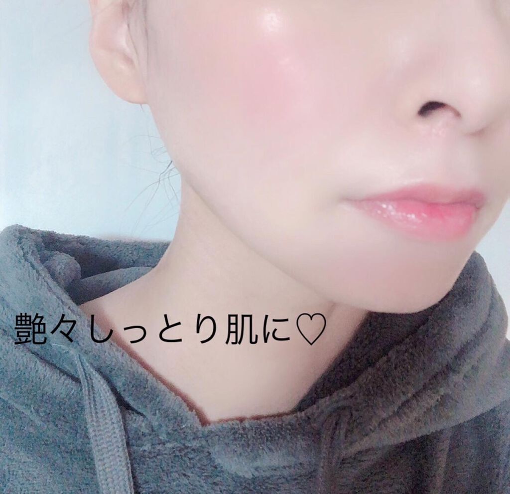 momoringo_5 on LIPS 「♡メディカルコスメで肌いきいき♡@evidin_officia..」(6枚目)