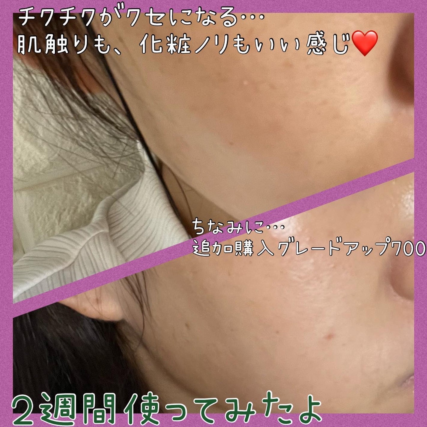 リードルショット300/VT/美容液を使ったクチコミ(5枚目)