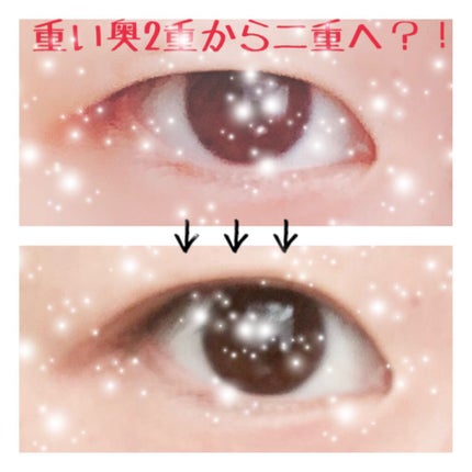 ルドゥーブル/ルドゥーブル/二重まぶた用アイテムを使ったクチコミ(1枚目)