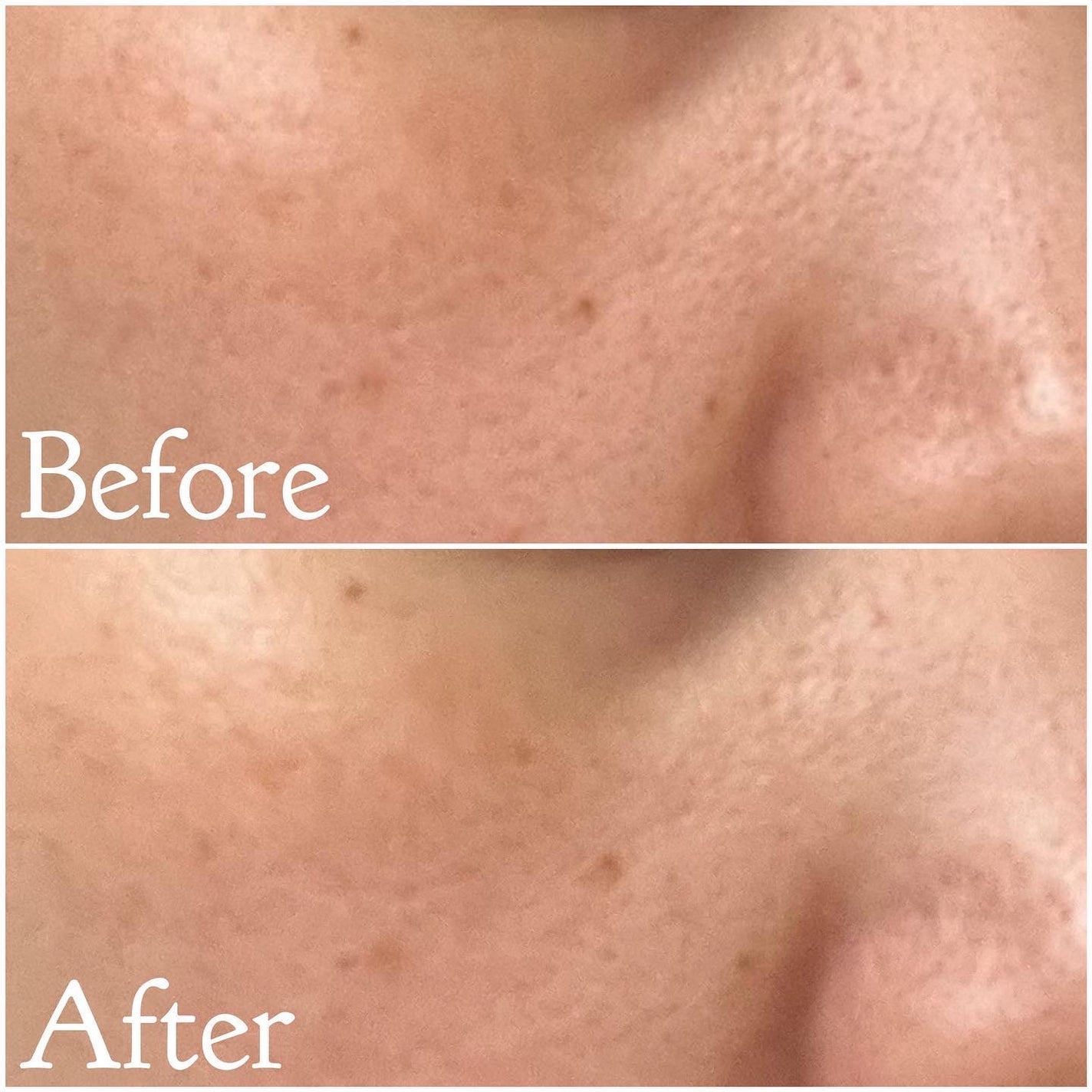 クレンジングバタープラス/クオリ/クレンジングクリームを使ったクチコミ(4枚目)