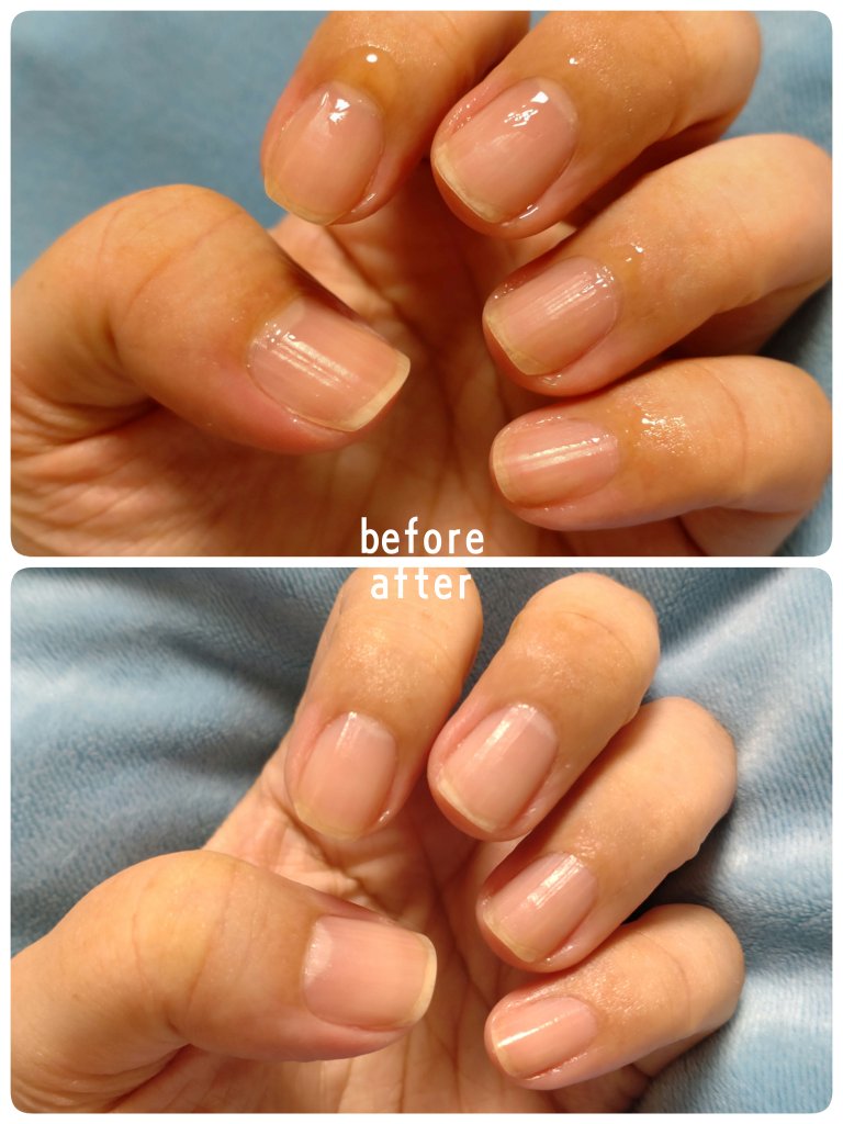 甘皮ケアオイル/無印良品/ネイルオイル・トリートメントを使ったクチコミ（3枚目）