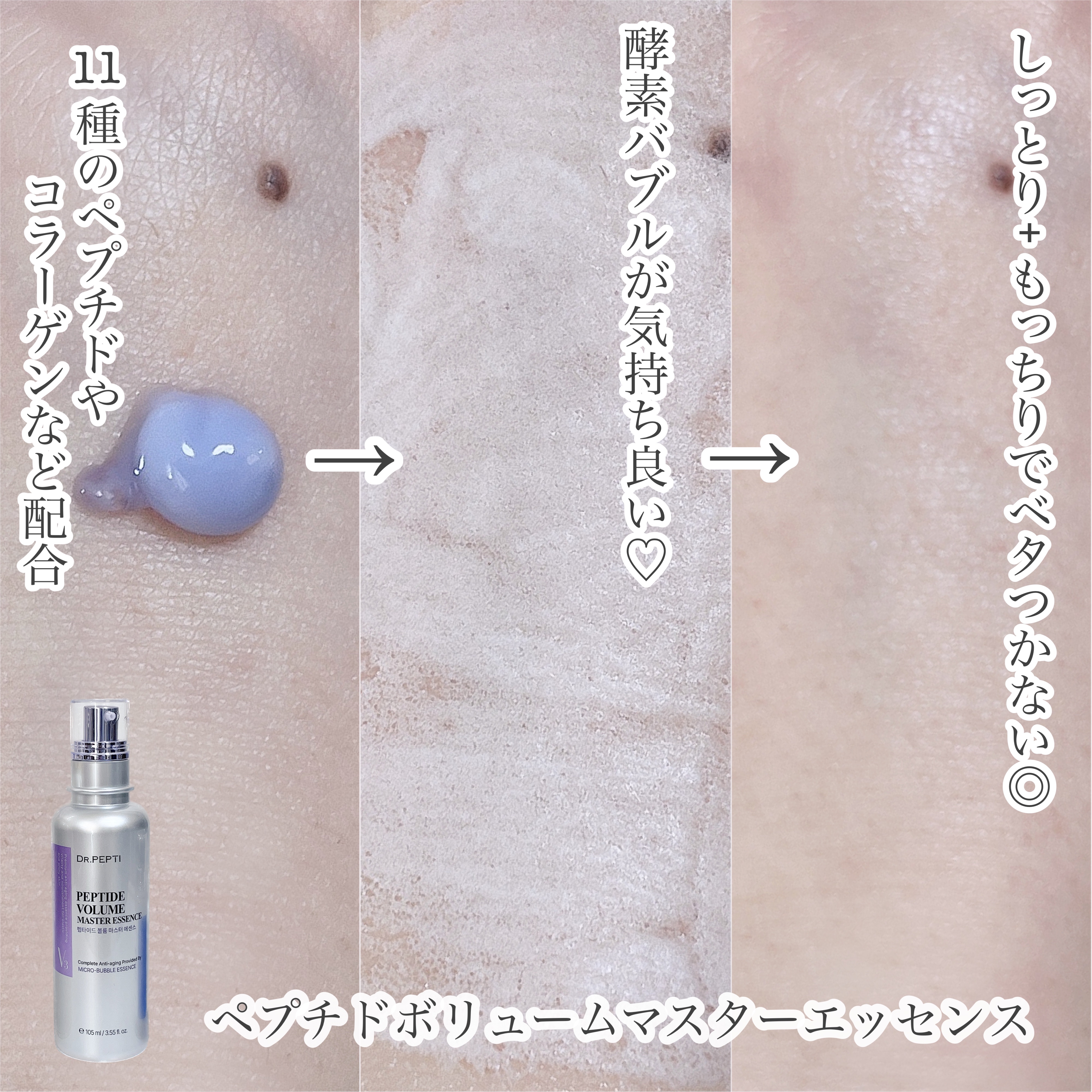 ペプチド ボリューム マスター エッセンス/DR.PEPTI/美容液を使ったクチコミ（3枚目）