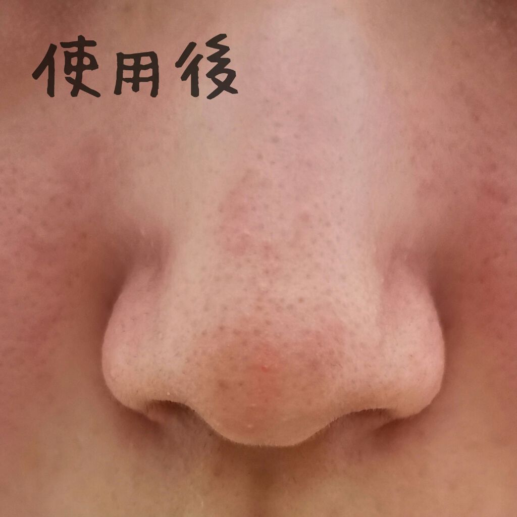 ベビーオイル ナチュラル/DAISO/ボディオイルを使ったクチコミ(6枚目)