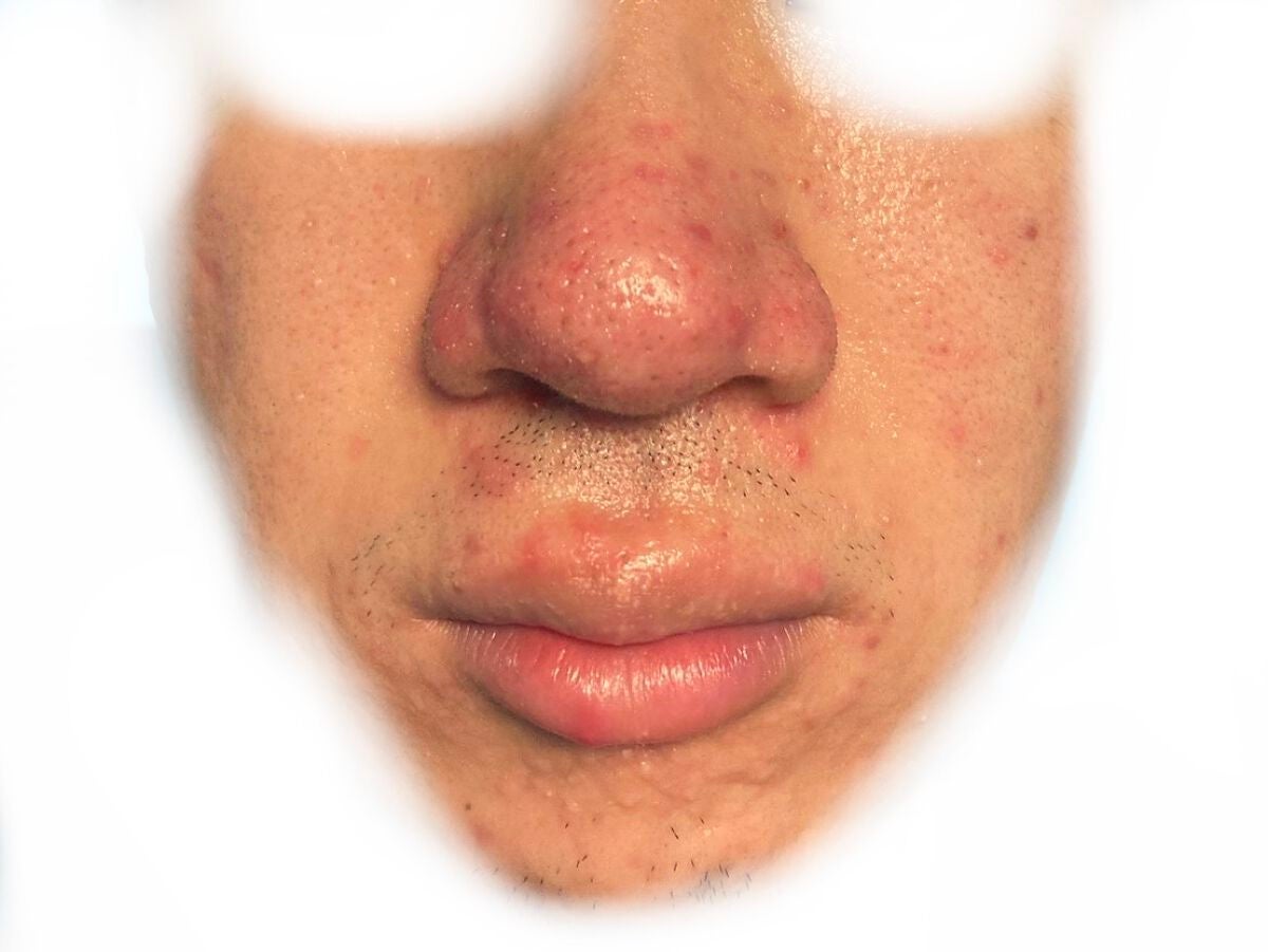 (フォロバ)3年後に韓国美男子 on LIPS 「CICA×HYALONフェスパック使用回数:16枚目特徴4:そ..」(2枚目)