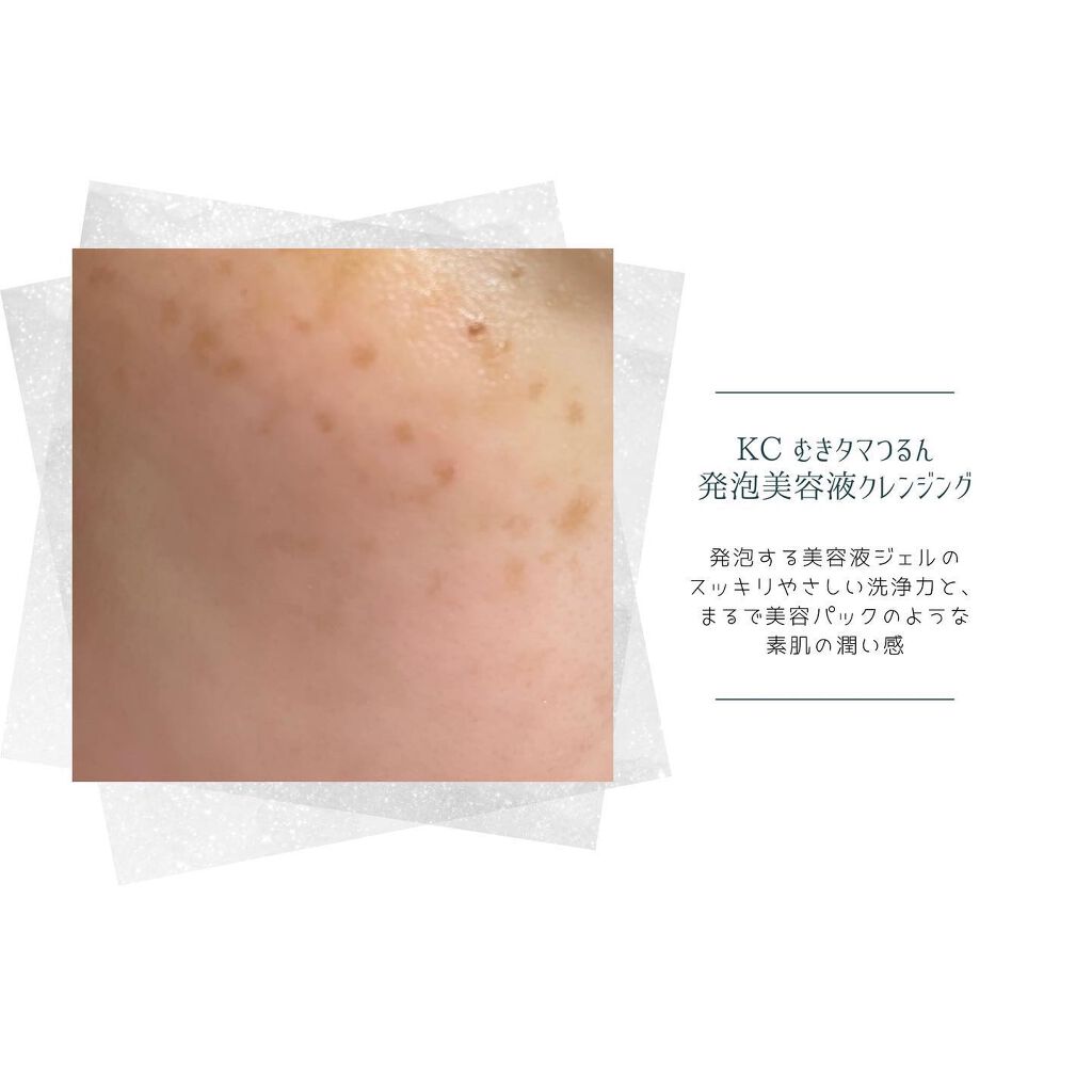 KC むきタマつるん 発泡美容液クレンジング/ハーブ健康本舗/クレンジングジェルを使ったクチコミ（3枚目）