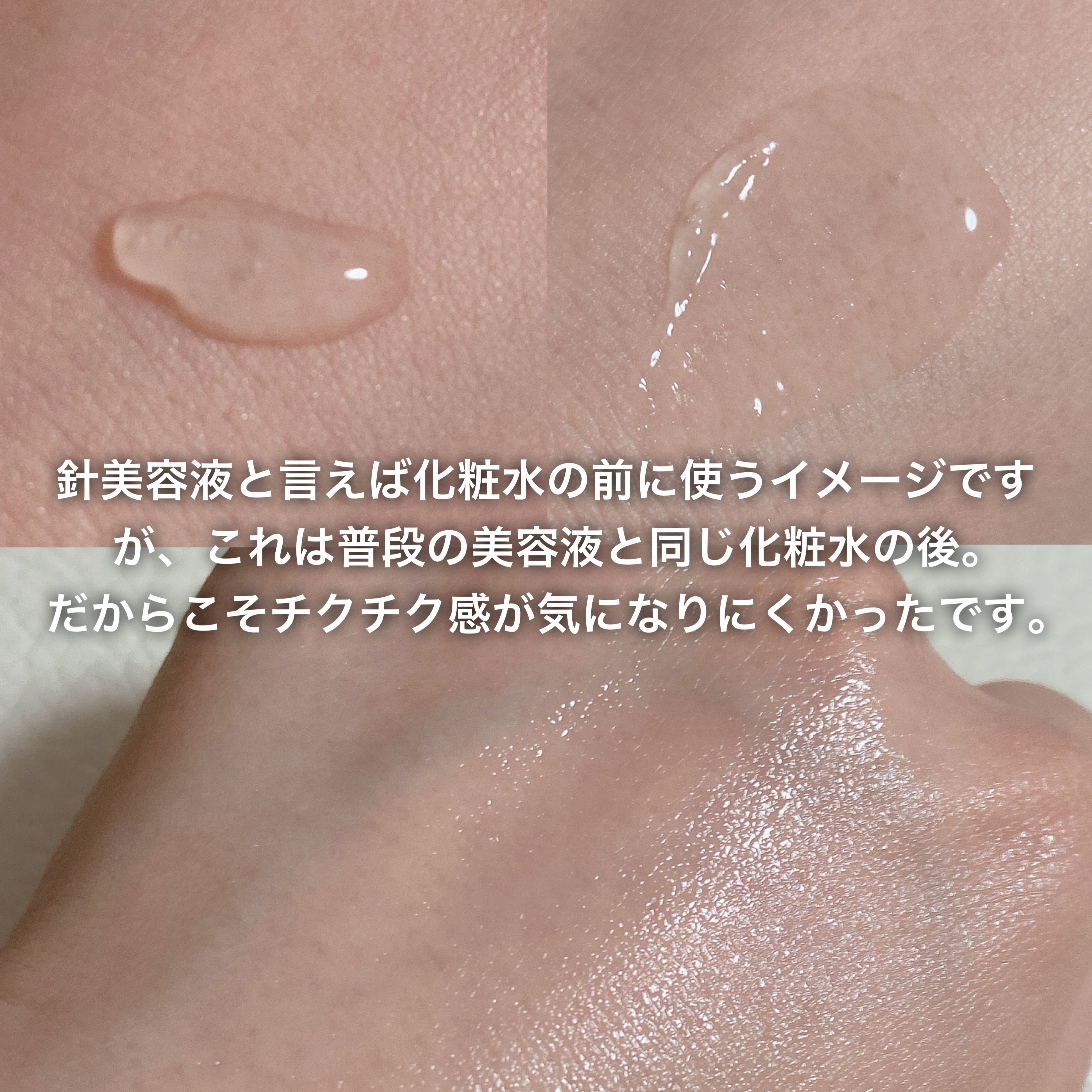 fractionalCC ニードルセラムC/fractionalCC/美容液を使ったクチコミ（2枚目）