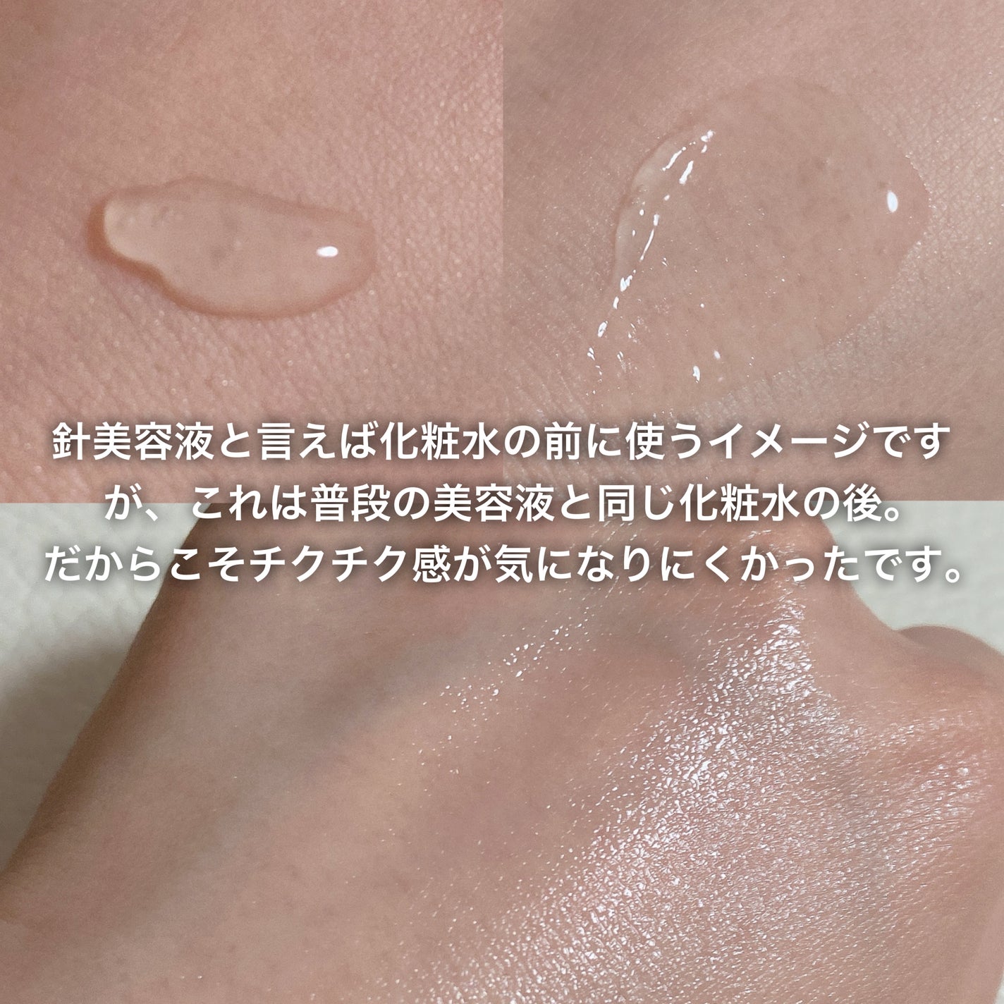 fractionalCC ニードルセラムC/fractionalCC/美容液を使ったクチコミ(2枚目)