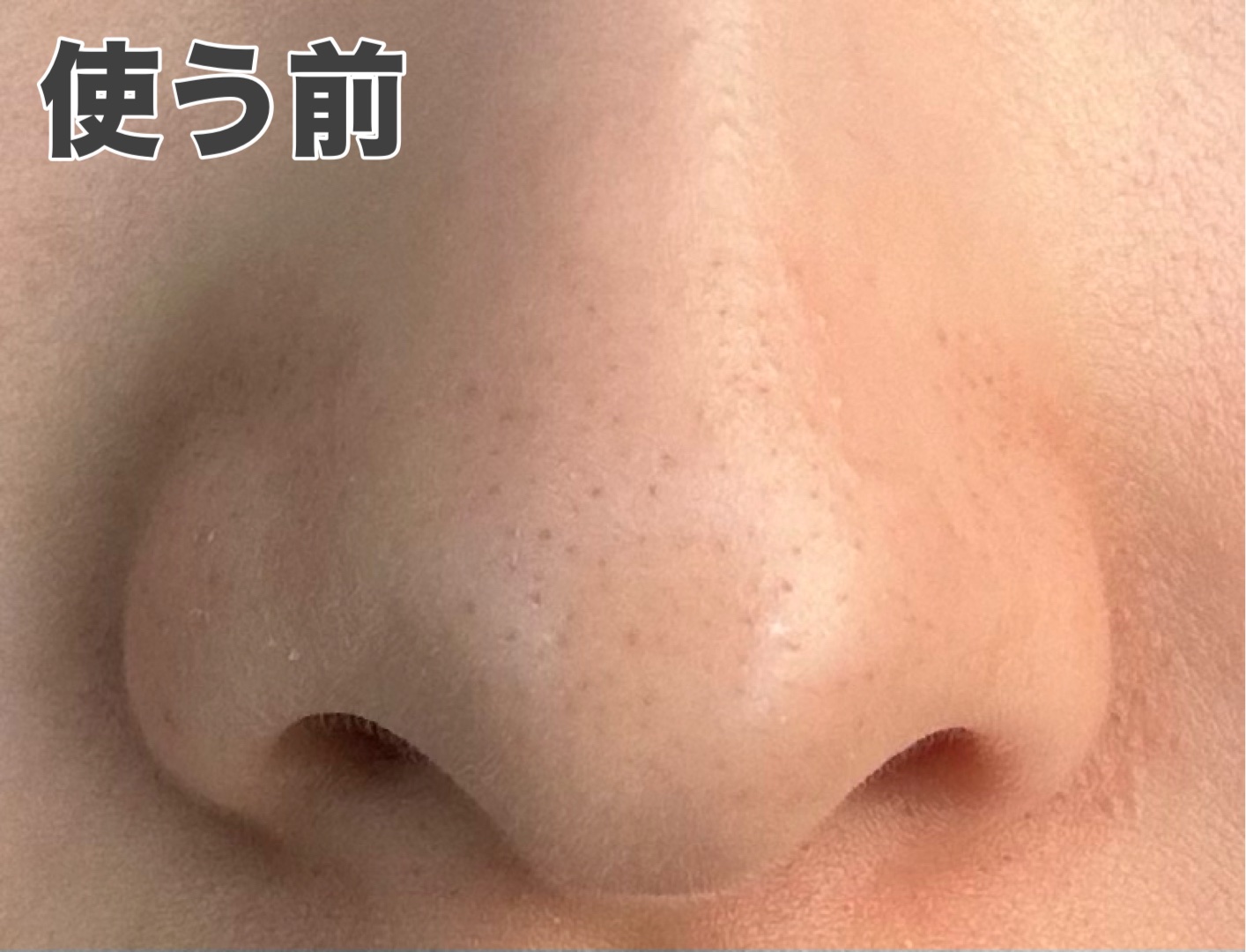 ディープクリア酵素洗顔	/メラノCC/洗顔フォームを使ったクチコミ（2枚目）