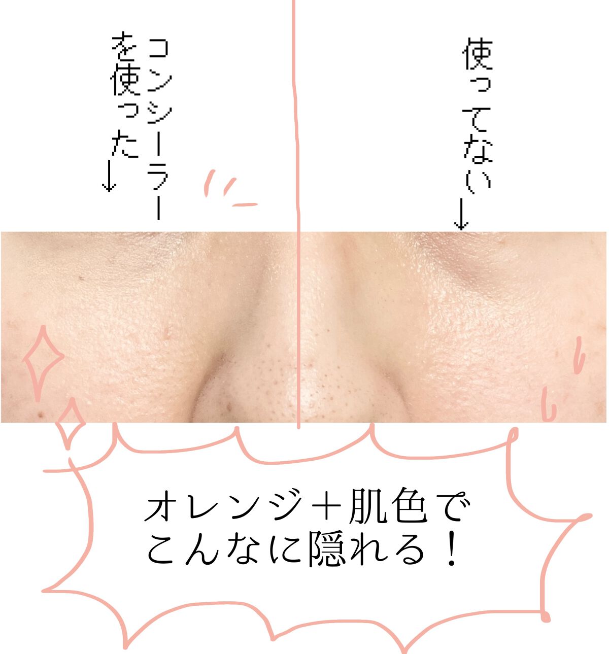 カラーミキシングコンシーラー/キャンメイク/パレットコンシーラーを使ったクチコミ(2枚目)