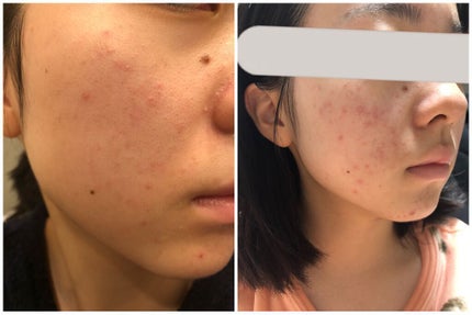 を使ったクチコミ(3枚目)