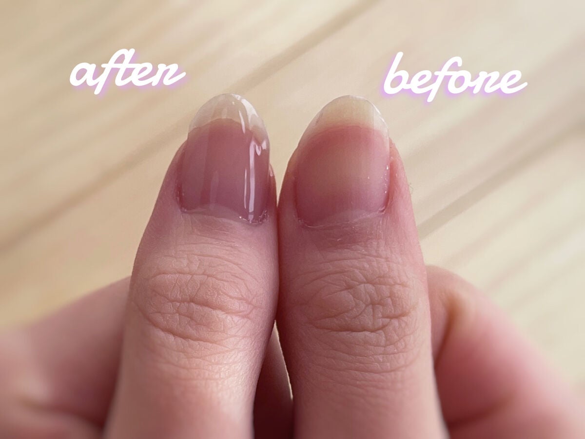 グロスフォーユアネイル/プレビュート/オールインワンネイルを使ったクチコミ(6枚目)