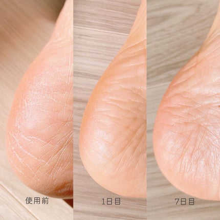 ゴウンバル クリーム/3WB/レッグ・フットケアを使ったクチコミ(3枚目)