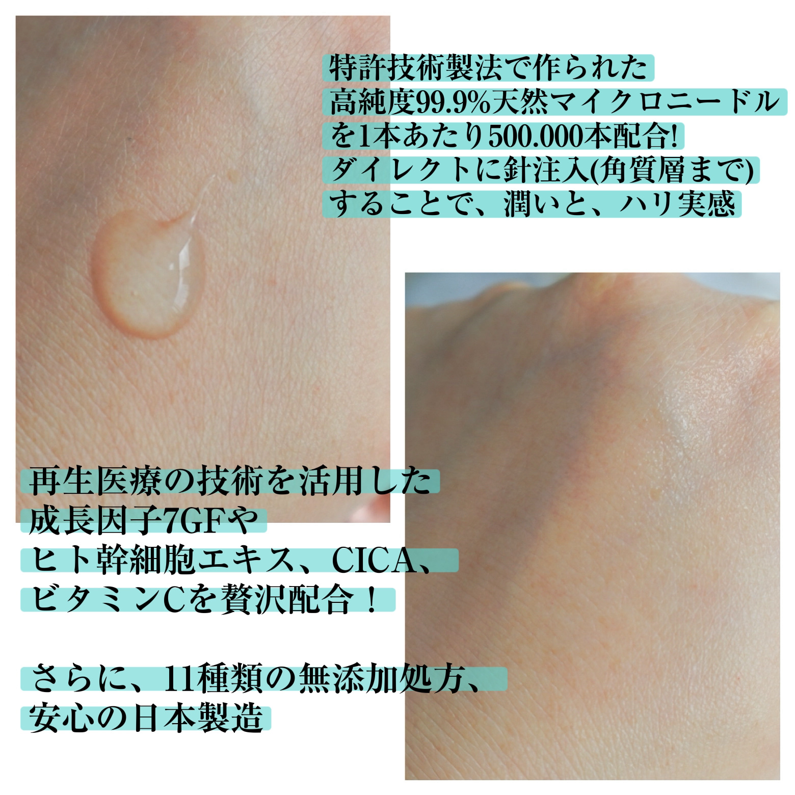 リードルリッチ パワーニードルセラム/REEDLE RICH/美容液を使ったクチコミ（3枚目）