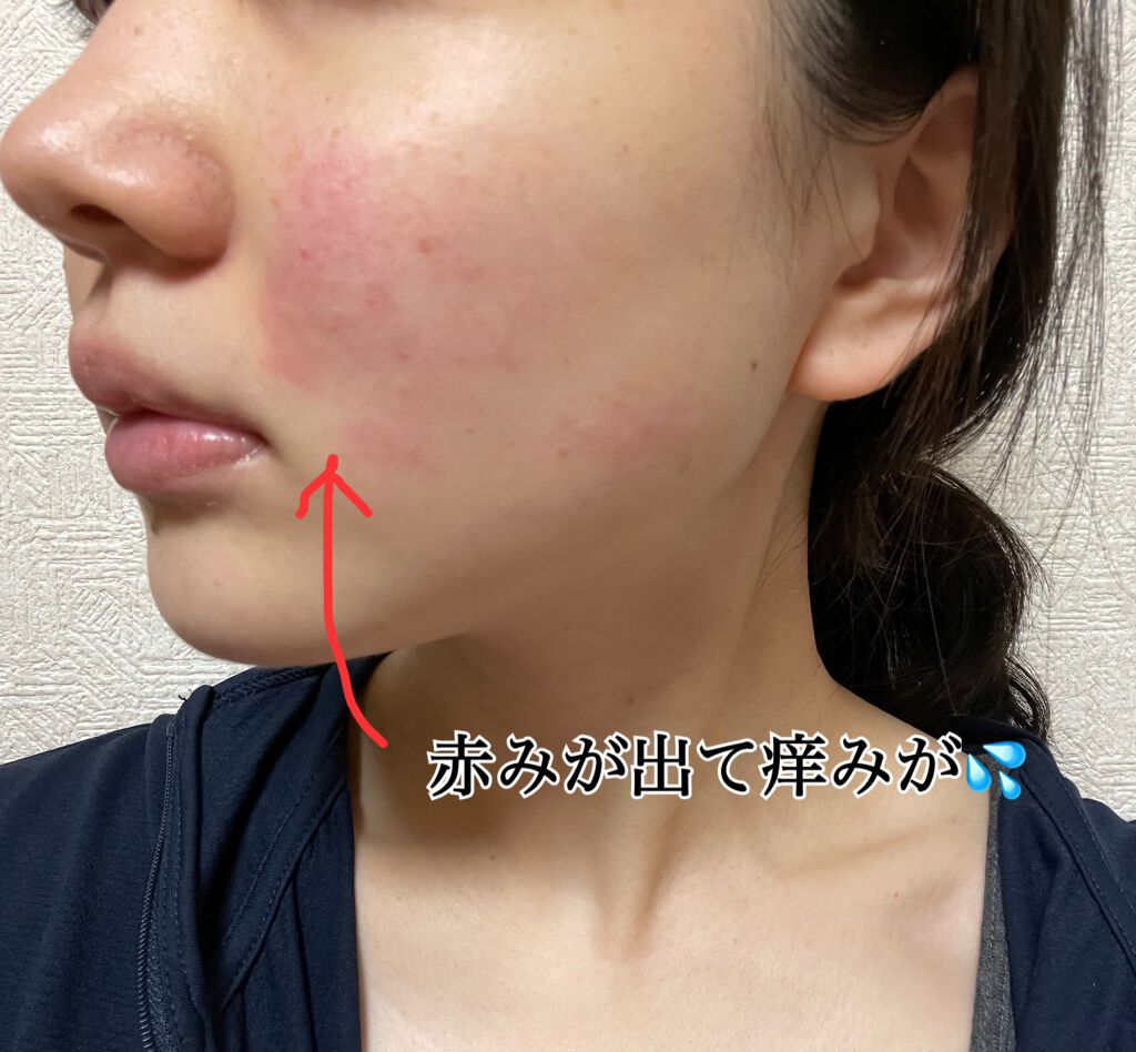 薬用 クリアローション M(しっとりタイプ)/オルビス/化粧水を使ったクチコミ(2枚目)