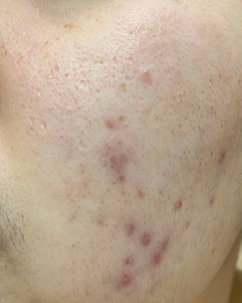 敏感肌用薬用美白美容液/無印良品/美容液を使ったクチコミ（3枚目）