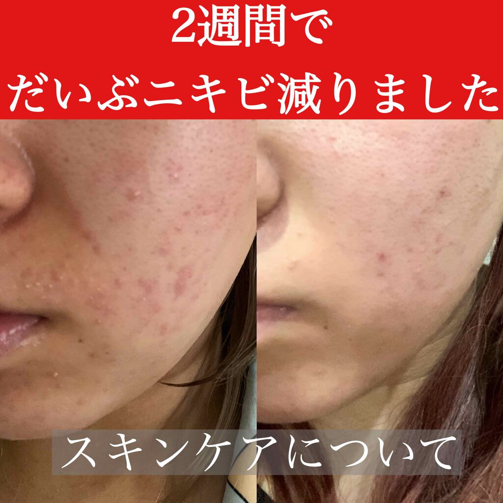 グリーンティーシード スキン/innisfree/化粧水を使ったクチコミ(1枚目)