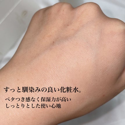 レディアンス ホワイト ローション/ステファニー/化粧水を使ったクチコミ(5枚目)