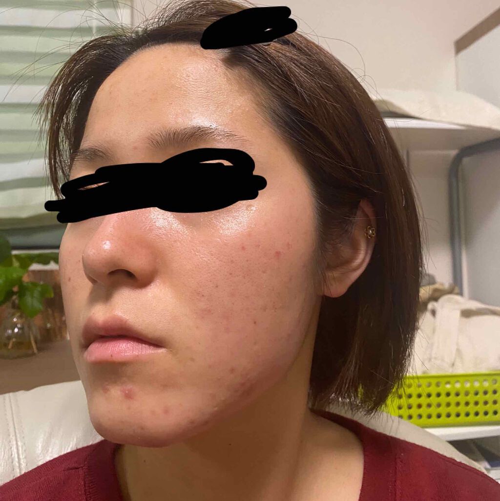 ルルルンプレシャス RED(モイスト)【旧】/ルルルン/シートマスク・パックを使ったクチコミ(4枚目)