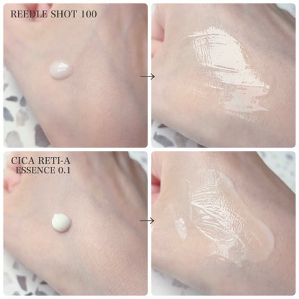 シカレチA エッセンス0.1/VT/美容液を使ったクチコミ(2枚目)