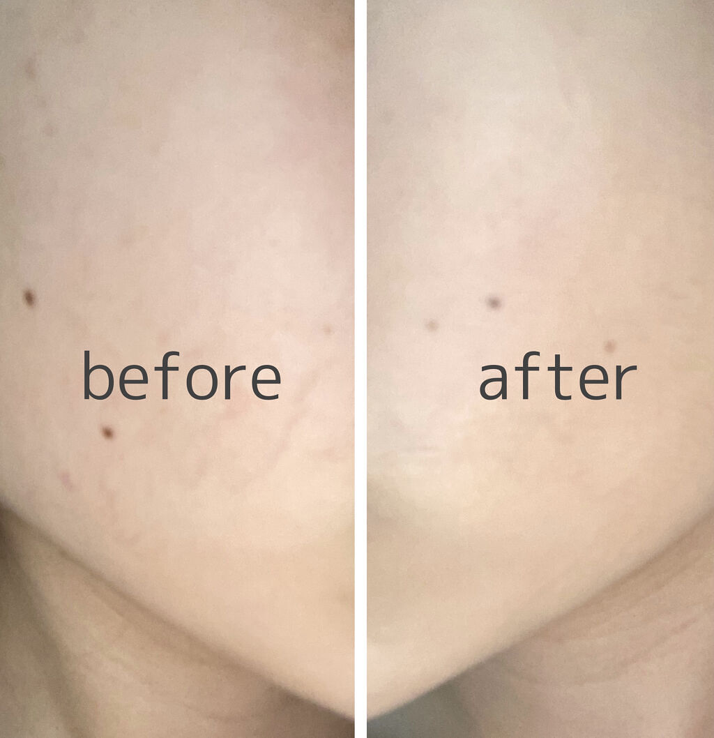 フィットミー リキッドファンデーション R/MAYBELLINE NEW YORK/リキッドファンデーションを使ったクチコミ（2枚目）