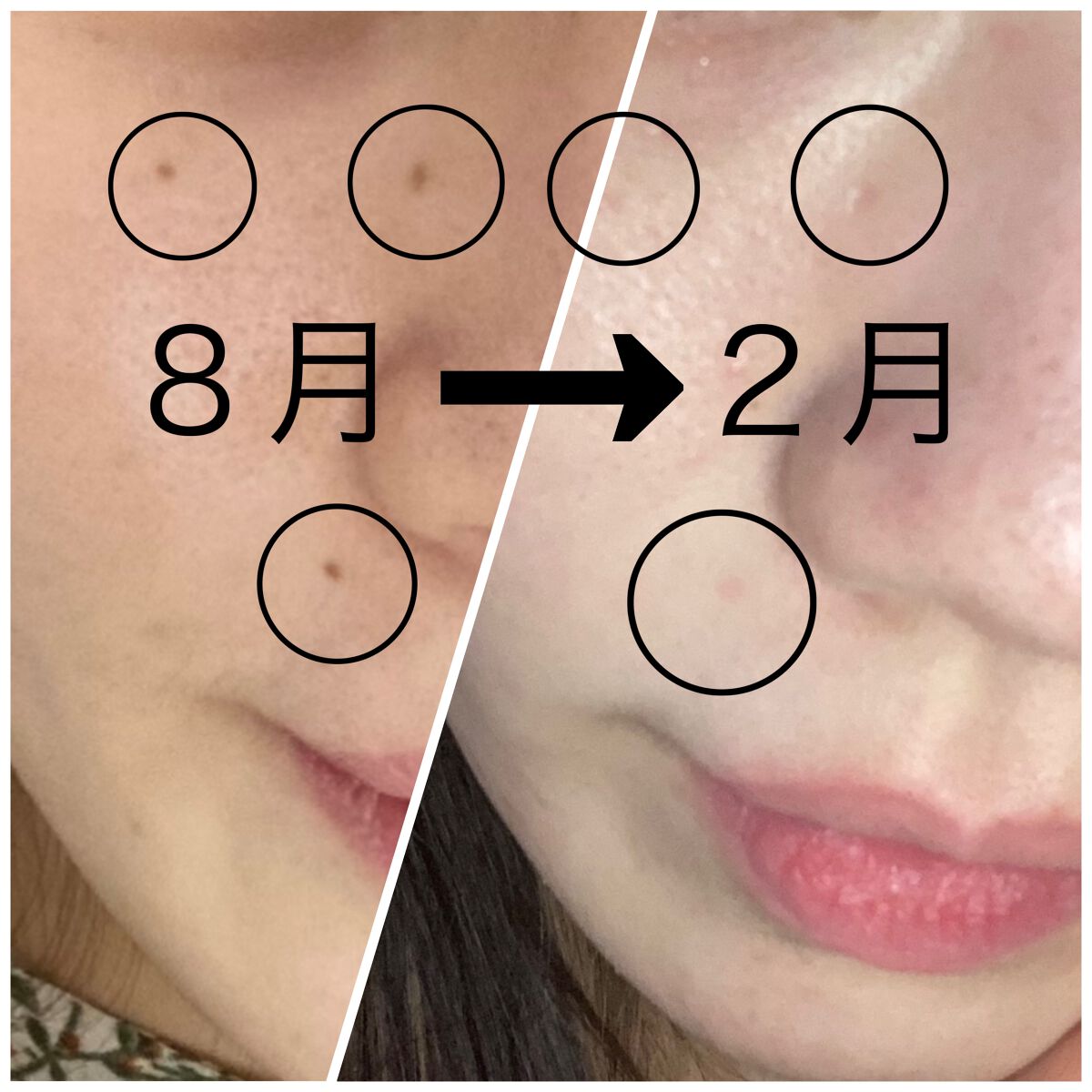 ããð§žâ¡ on LIPS ãã»ããé€å»ãã4ã¶æçµã¡ãŸããã®ã§åã³ã¬ãã¥ãŒðã»ããé€å»ããŠ..ãïŒ1æç®ïŒ