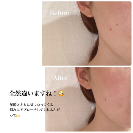 薬用リンクルカバーファンデーション〈シワ改善ファンデーション〉/WrinkFade/リキッドファンデーションを使ったクチコミ(8枚目)