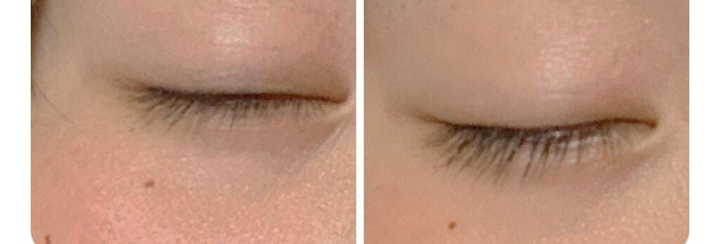 スカルプD ボーテ ピュアフリーアイラッシュセラム/アンファー(スカルプD)/まつげ美容液を使ったクチコミ(1枚目)