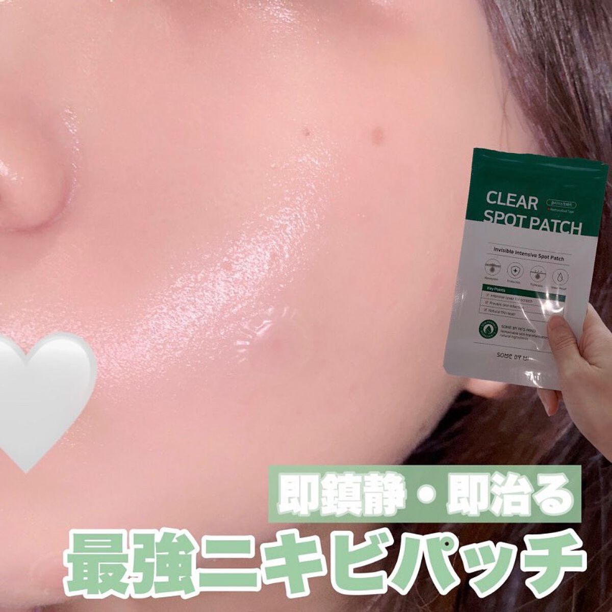 SOME BY MI 30デイズミラクルクリアスポットパッチのクチコミ「【触らない！潰さない！】
最強のニキビパッチを見つけてしまった！

サムバイミーのニキビパッチ.....」（1枚目）