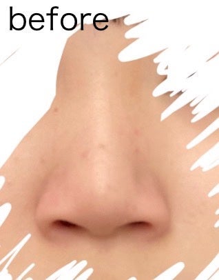 âð€ð𪜠on LIPS ãçããããã«ã¡ã¯!錻ãå°ããããæ¹æ³ã§ããããã¡ããã®éŒ»ããã..ãïŒ5æç®ïŒ