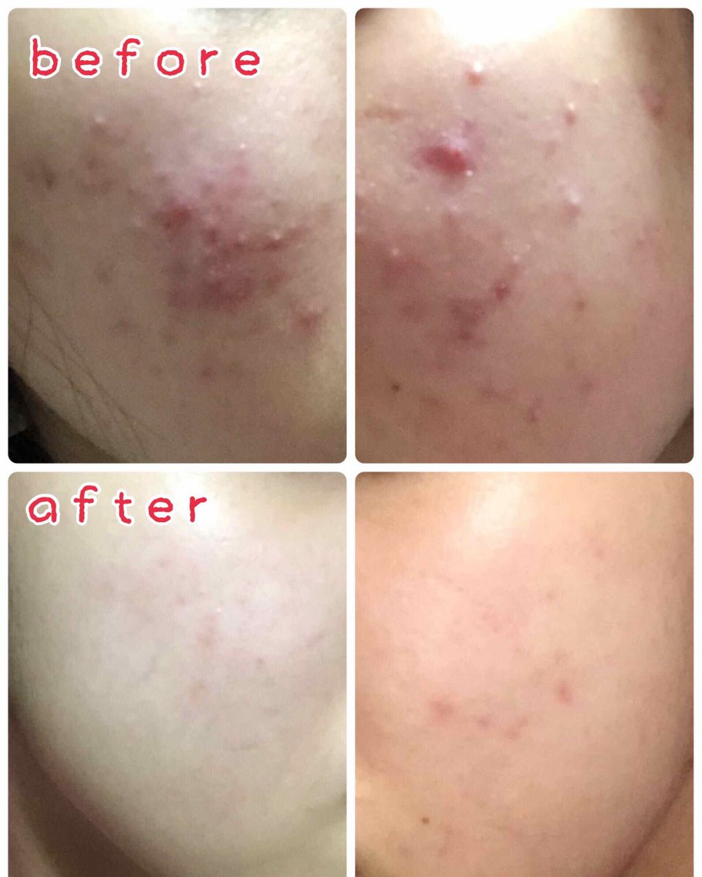 化粧水・敏感肌用・しっとりタイプ/無印良品/化粧水を使ったクチコミ（3枚目）