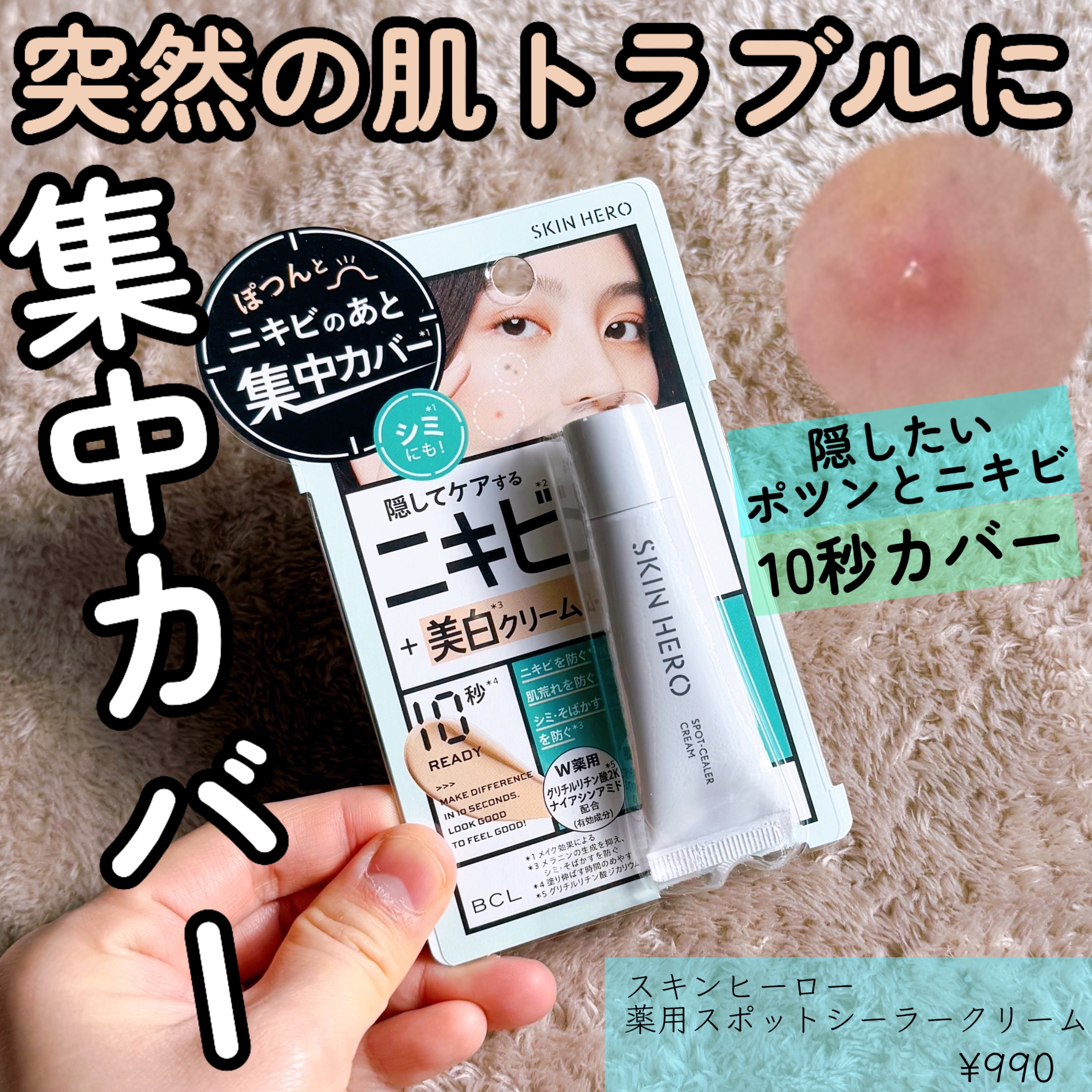 薬用スポットシーラークリーム/スキンヒーロー/クリームコンシーラーを使ったクチコミ（1枚目）