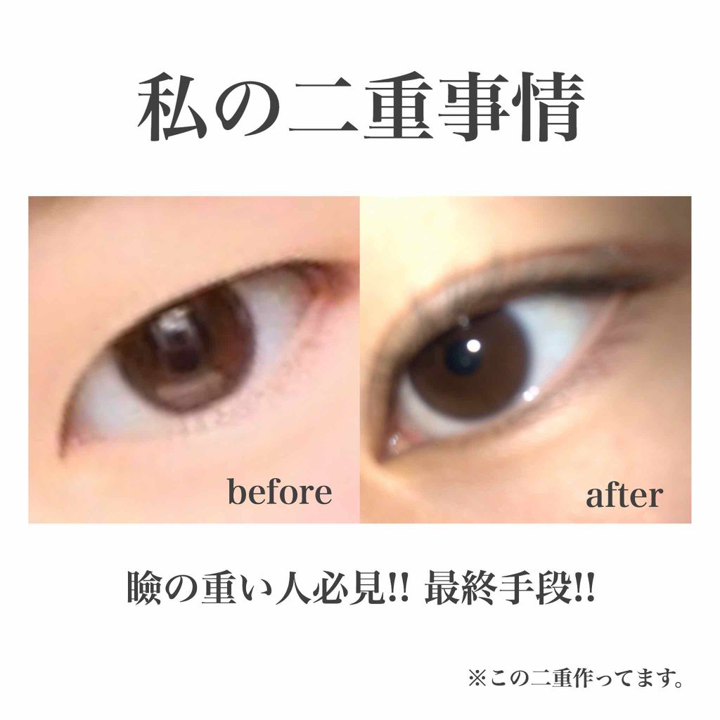 絆創膏/DAISO/その他を使ったクチコミ（1枚目）