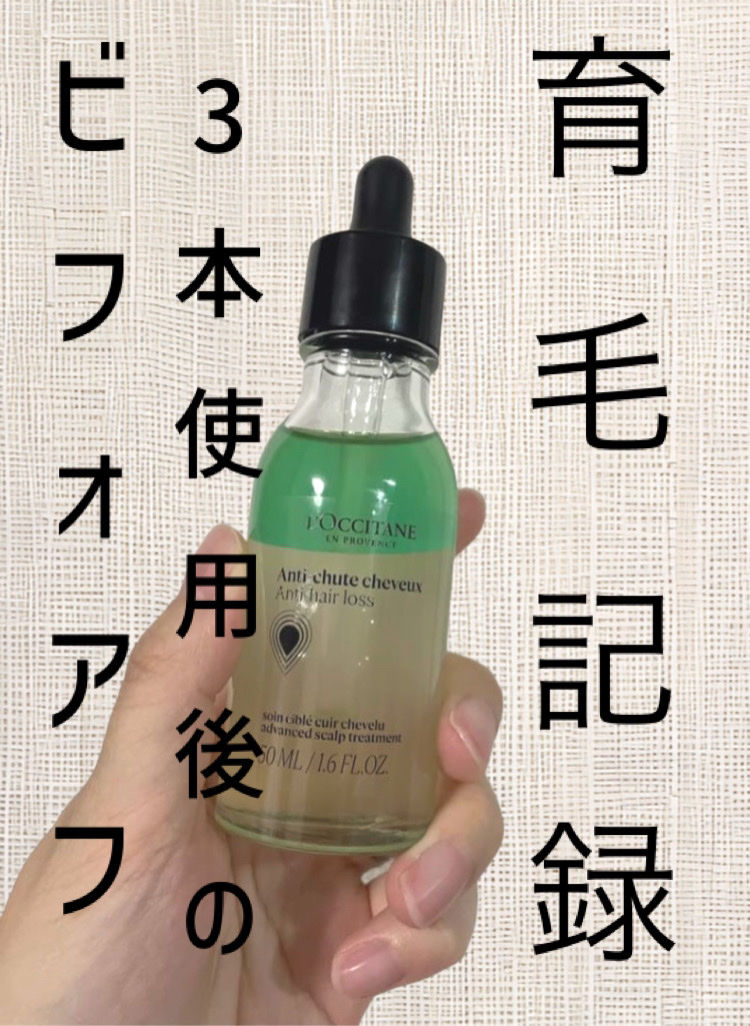 薬用 メディカル アンチヘアロスセラム/L'OCCITANE/頭皮ローションを使ったクチコミ（1枚目）