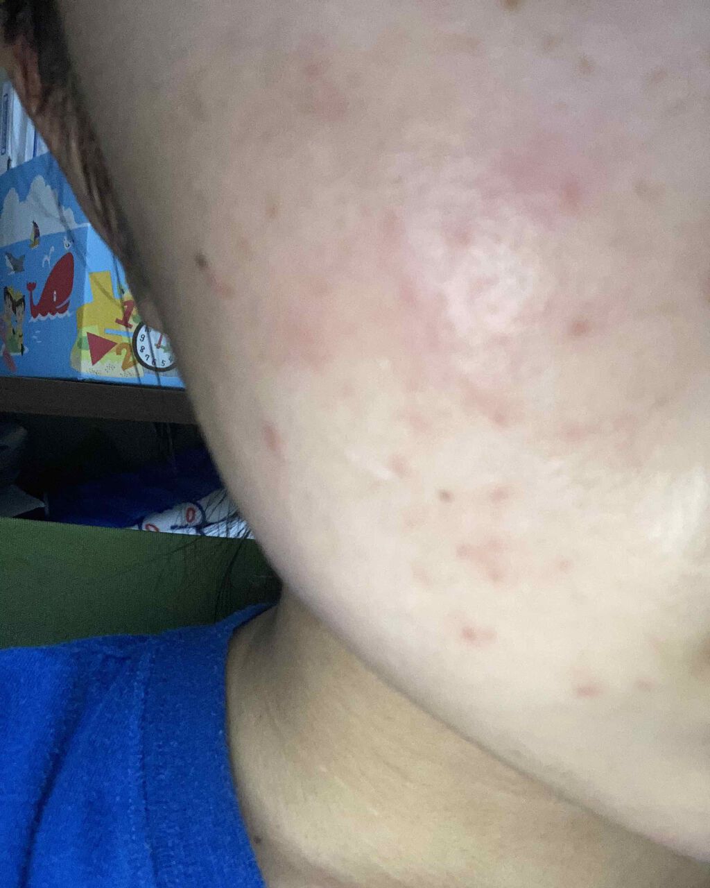 ワセリン/大洋製薬/ボディクリームを使ったクチコミ（3枚目）