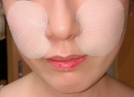 ティーツリーカーミングエッセンスパッド/MEDIHEAL/トナーパッドを使ったクチコミ(5枚目)