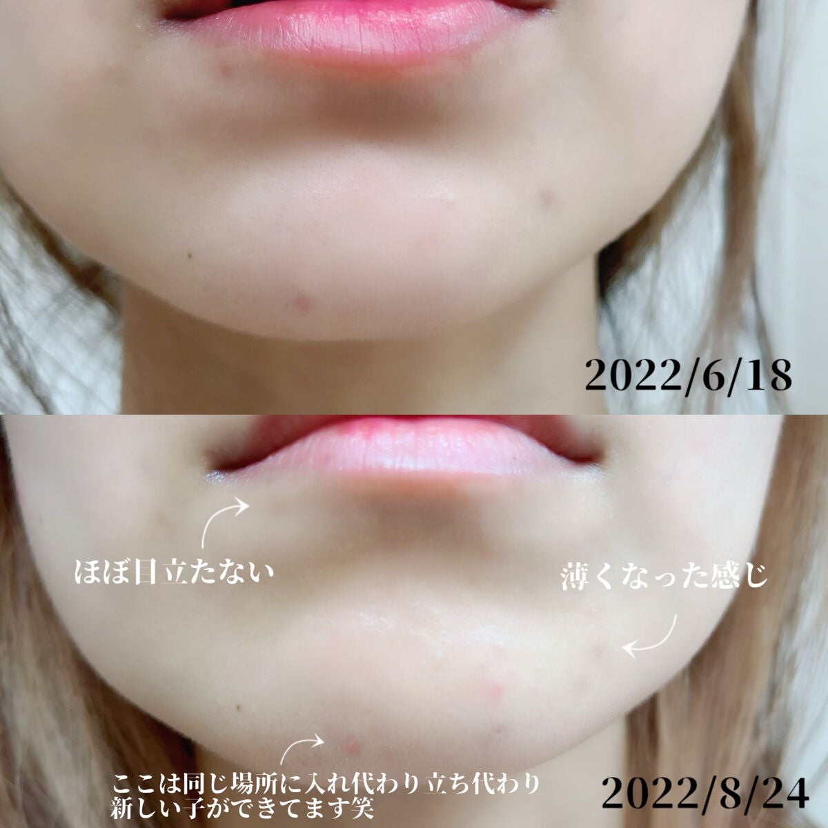 ムードペブルネイル/rom&nd/マニキュアを使ったクチコミ(7枚目)