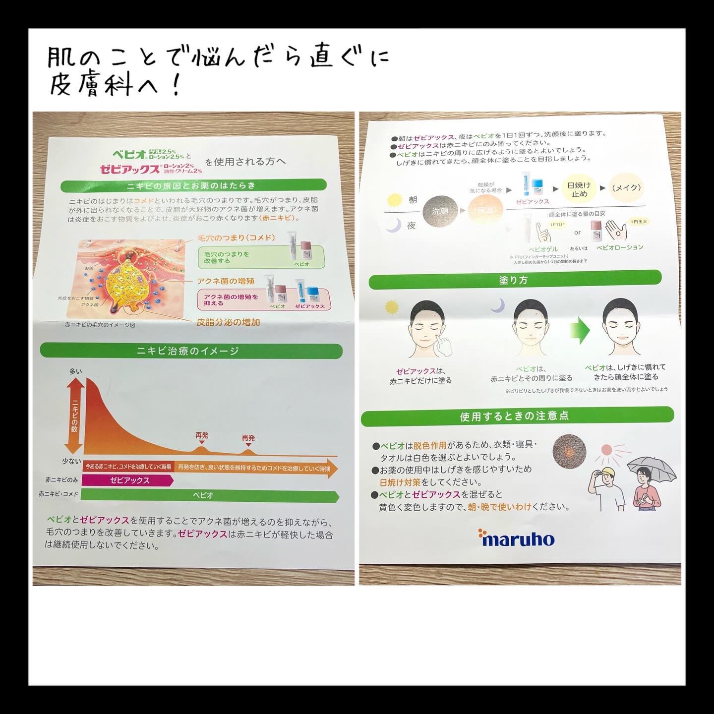 ヘパリン類似物質油性クリーム/日医工ファーマ/その他スキンケアを使ったクチコミ（2枚目）