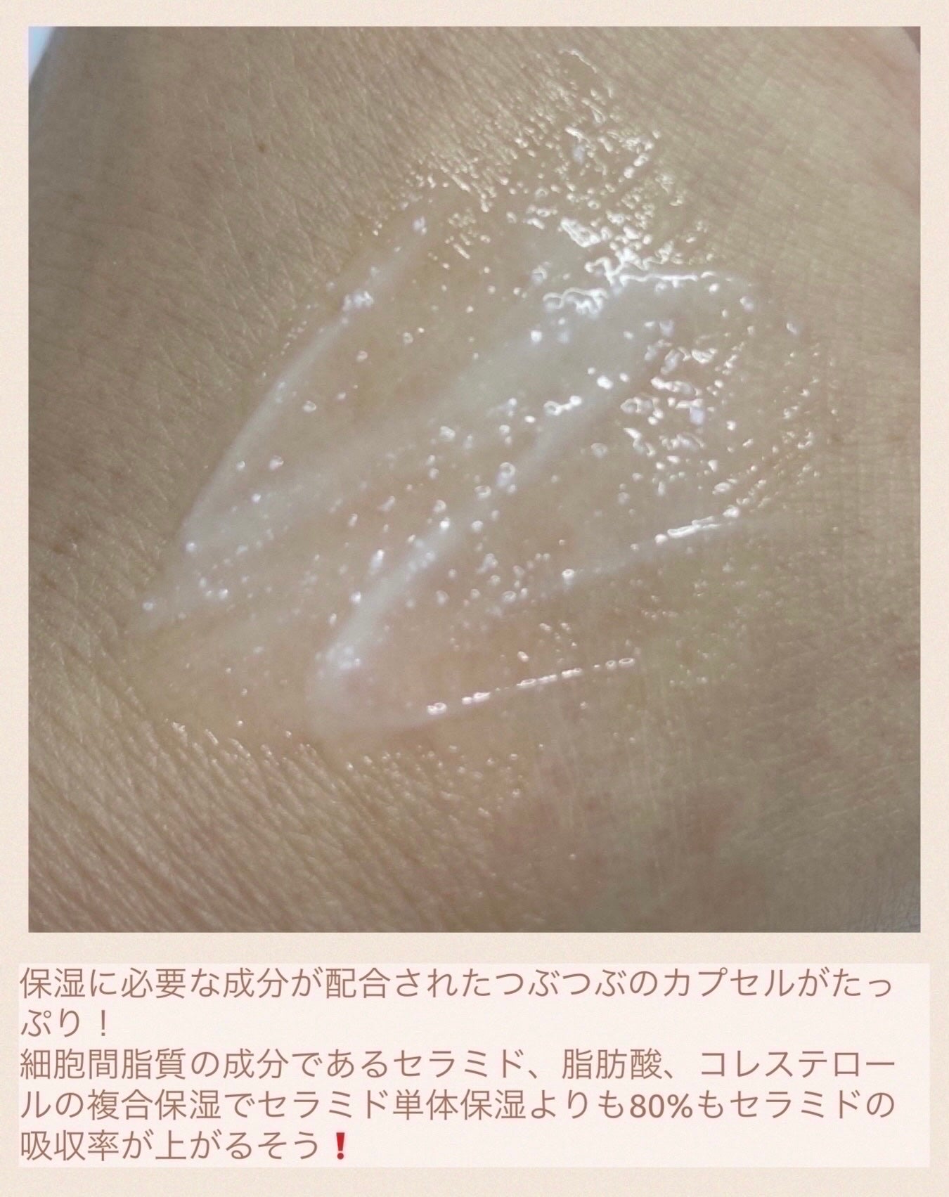 アトバリア365クリーム/AESTURA/フェイスクリームを使ったクチコミ(2枚目)