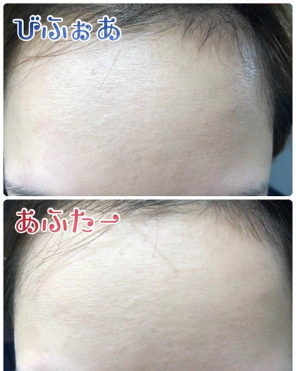 スノービューティー ホワイトニング フェースパウダー 2018/スノービューティー/プレストパウダーを使ったクチコミ(4枚目)